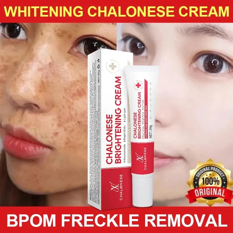 CHALONESE Brightening Cream – 20g